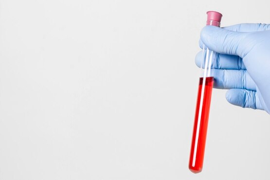 Mão de luva segurando tubo de ensaio com líquido vermelho.