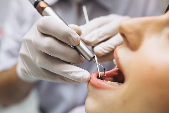 Mulher fazendo procedimento odontológico.