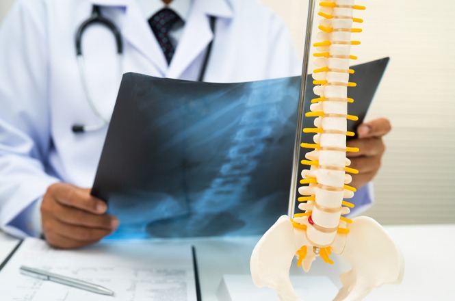 Foto colorida: médico analisa raio‑X ao lado de modelo de coluna, consultório clínico interno, diagnóstico ortopédico, avaliando exame em branco, azul e amarelo