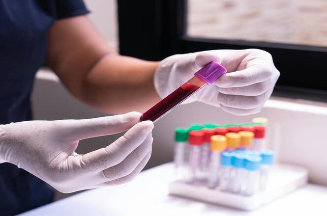 Foto horizontal: mãos com luvas seguram tubo de sangue em laboratório com frascos coloridos ao fundo.