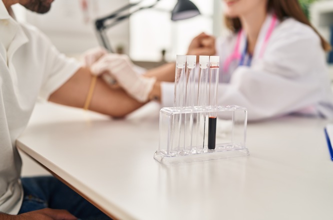 Foto horizontal: tubos com amostras de sangue em primeiro plano, enquanto profissional de saúde realiza coleta em paciente, em imagem ilustrativa sobre exames laboratoriais e diagnóstico clínico.